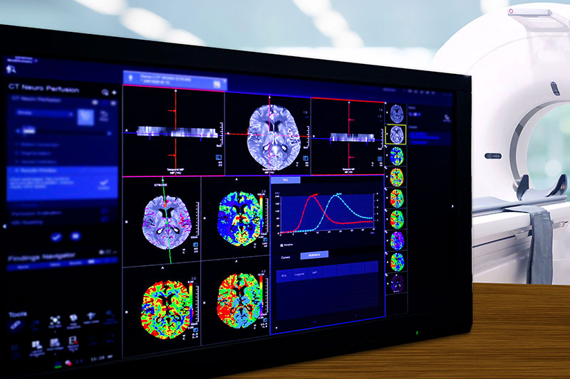 Brain Perfusion or CT scan of Blood flow in the brain 3d rendering image on the screen with CT Scan room.