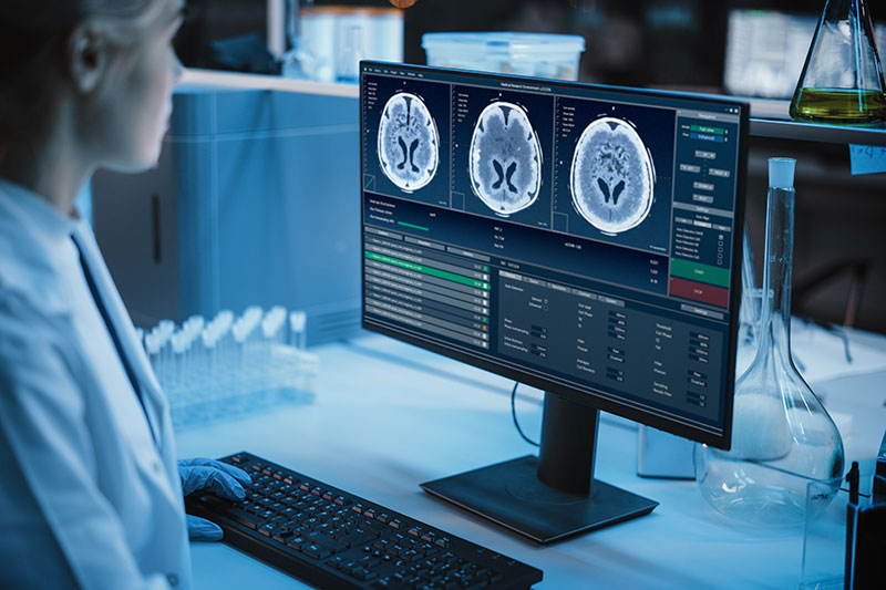 Medical Research Laboratory: Portrait of Female Scientist Working on Computer Showing MRI Brain Scans.